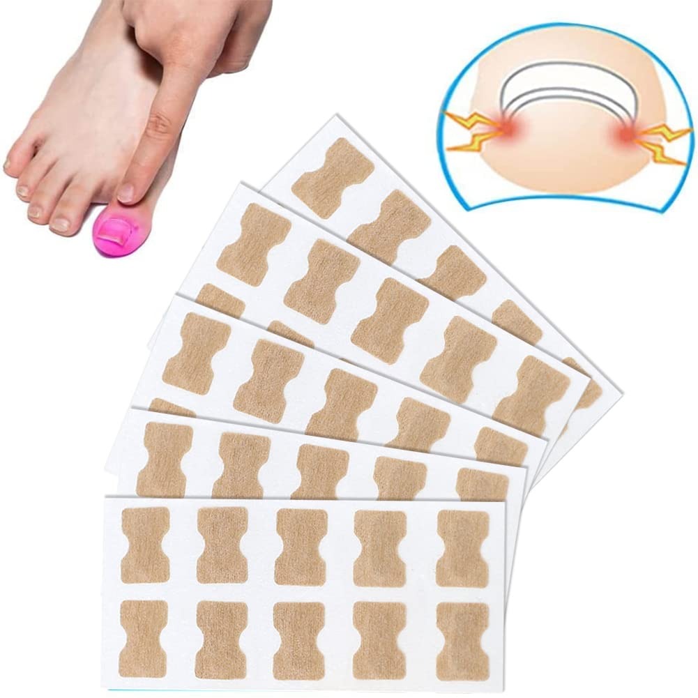 🦶✨ Parche Corrector de Uñas Encarnadas – Pack x50 unidades