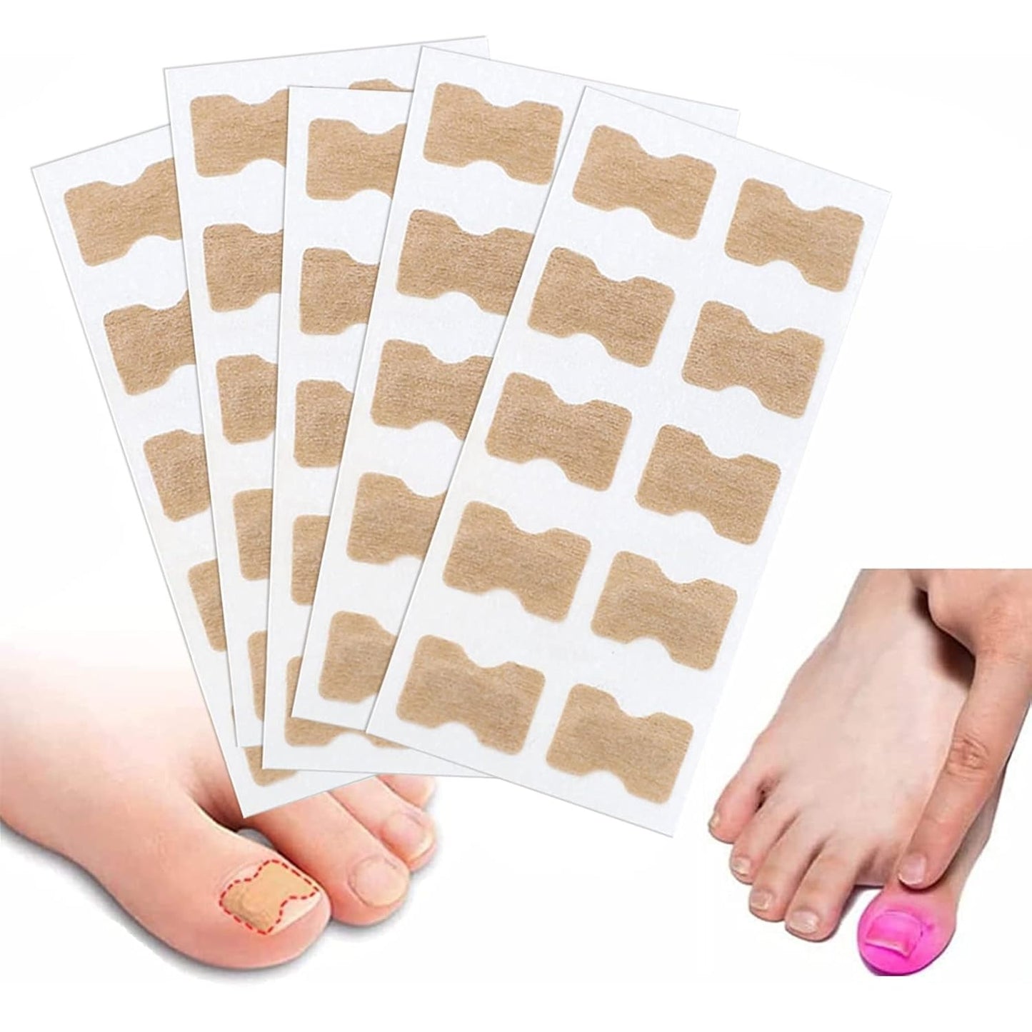 🦶✨ Parche Corrector de Uñas Encarnadas – Pack x50 unidades