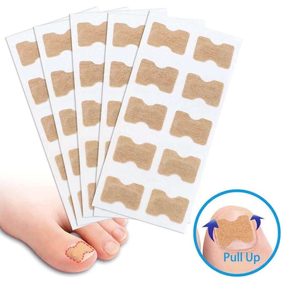 🦶✨ Parche Corrector de Uñas Encarnadas – Pack x50 unidades