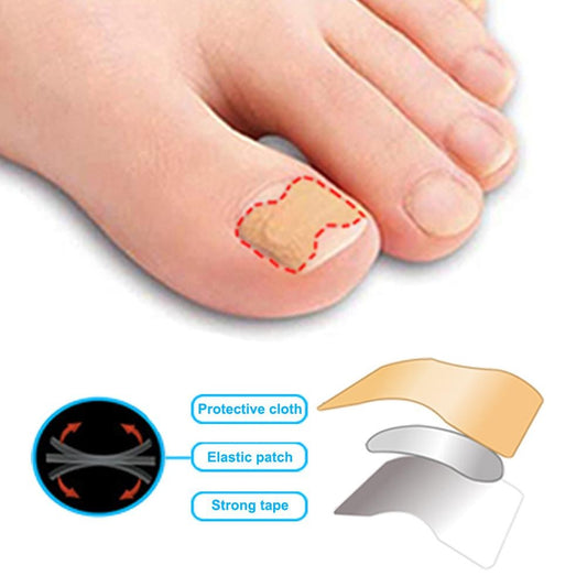 🦶✨ Parche Corrector de Uñas Encarnadas – Pack x50 unidades
